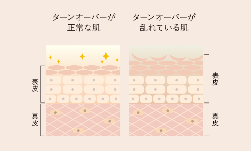 ターンオーバーの仕組み