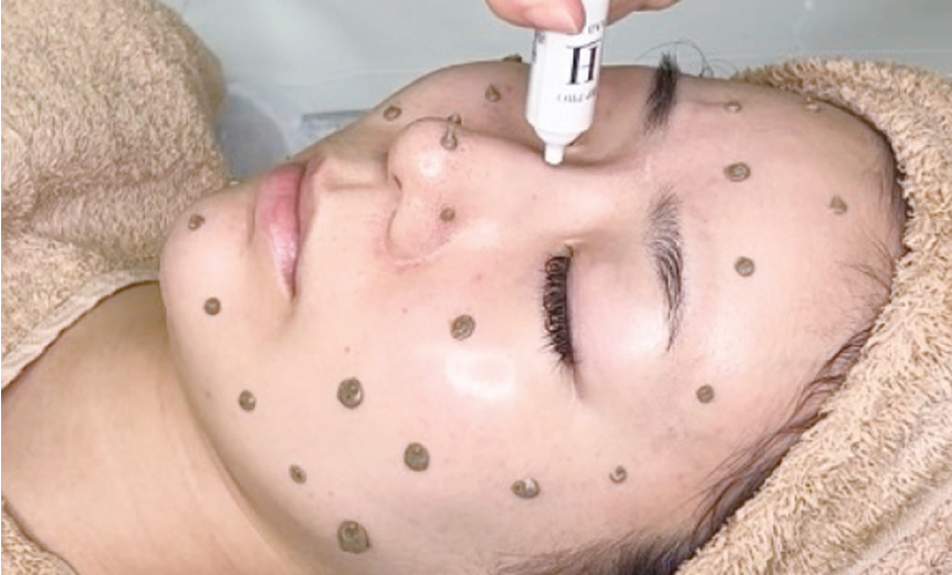 “クリニックレベルをサロンへ”