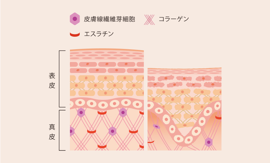 エクソソームの説明2