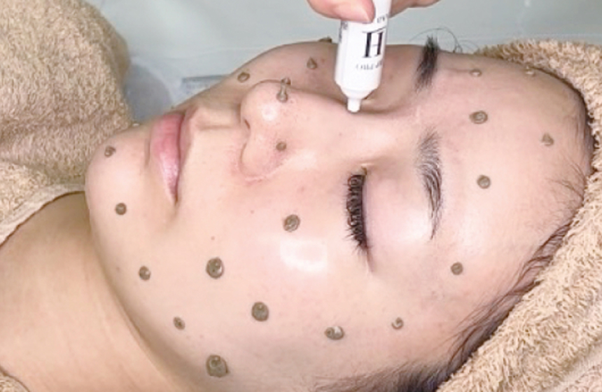 エクソソームの説明1