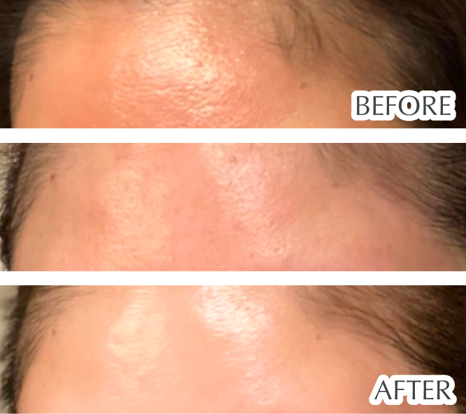 シワ、くすみ、乾燥